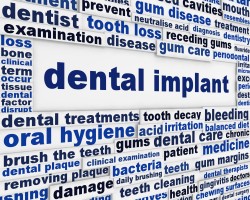 dental implant with other related keywords