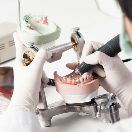 our Fulshear dentist can restore your smile using tooth caps